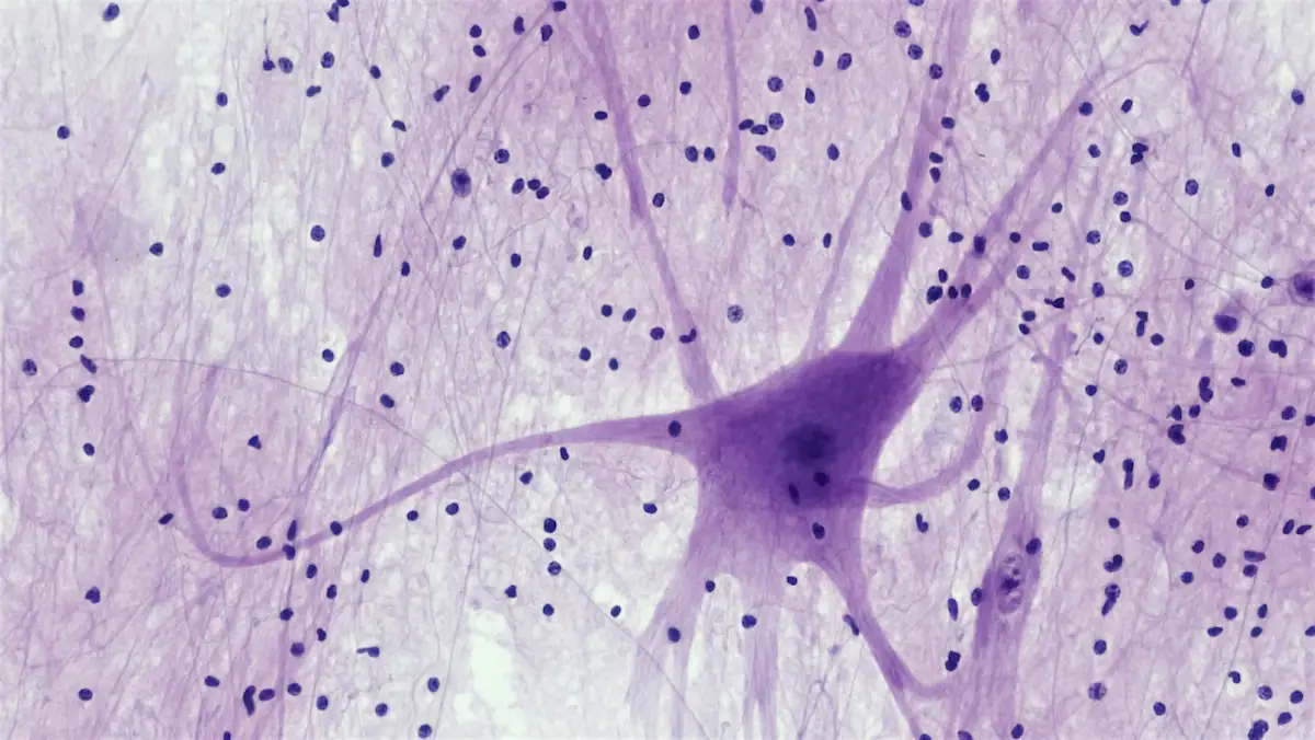 Fluorescent microscope image of branching neurons in the human brain, glowing cell bodies and long dendrites against a purple background