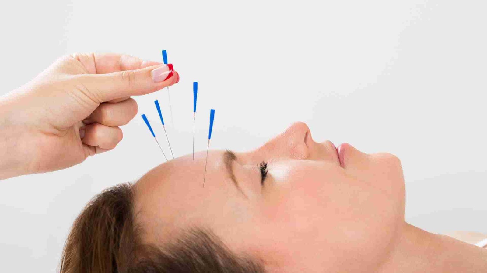 Facial Acupuncture