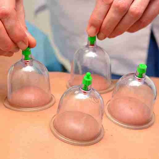 Acupuncture at AyurSoul Healthcare