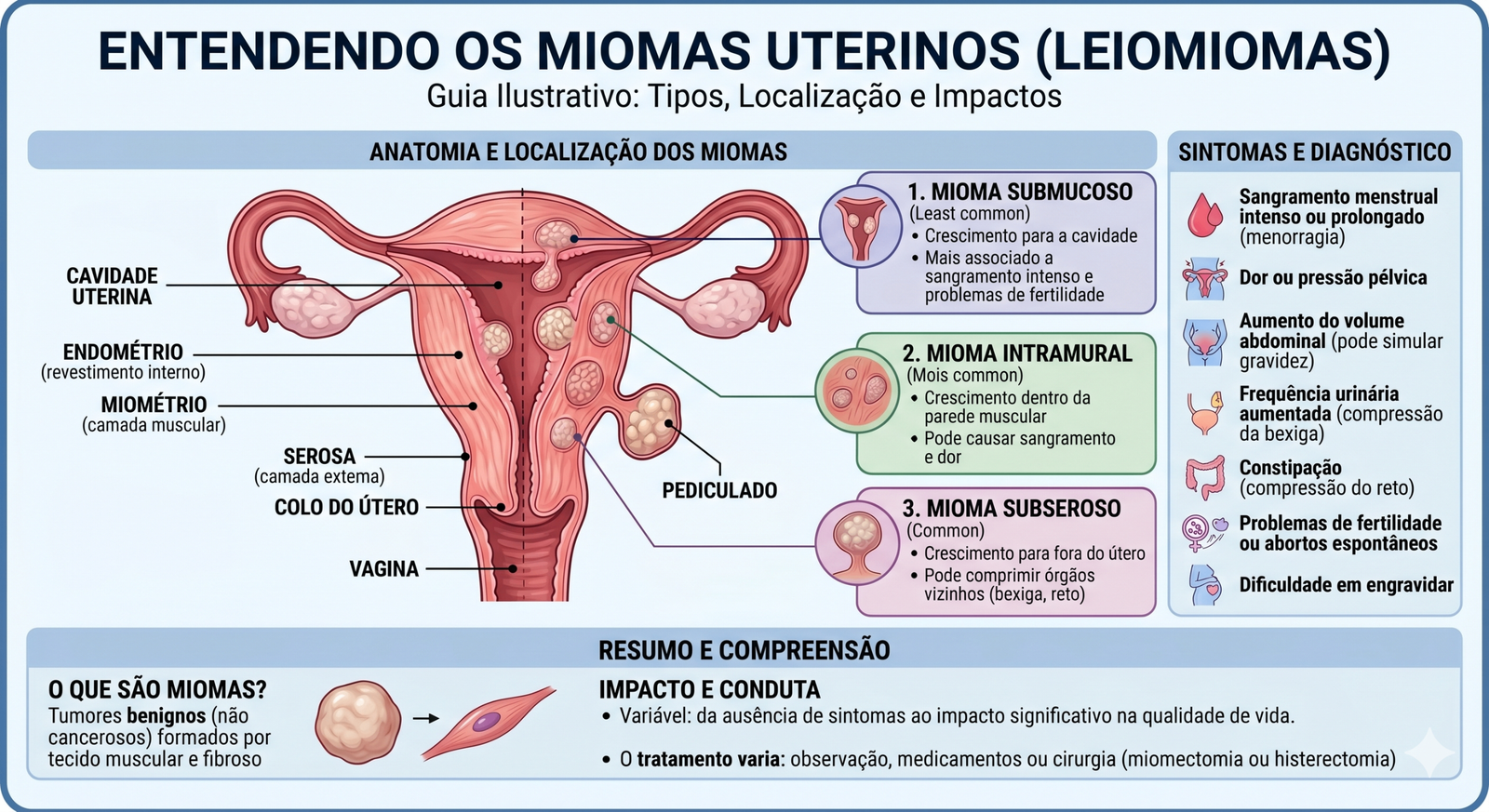 Miomas Uterinos