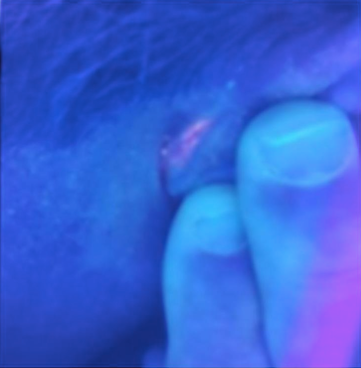 Derrière des oreilles sous UV