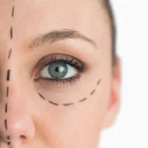 Χειρουργική Οφθαλμών