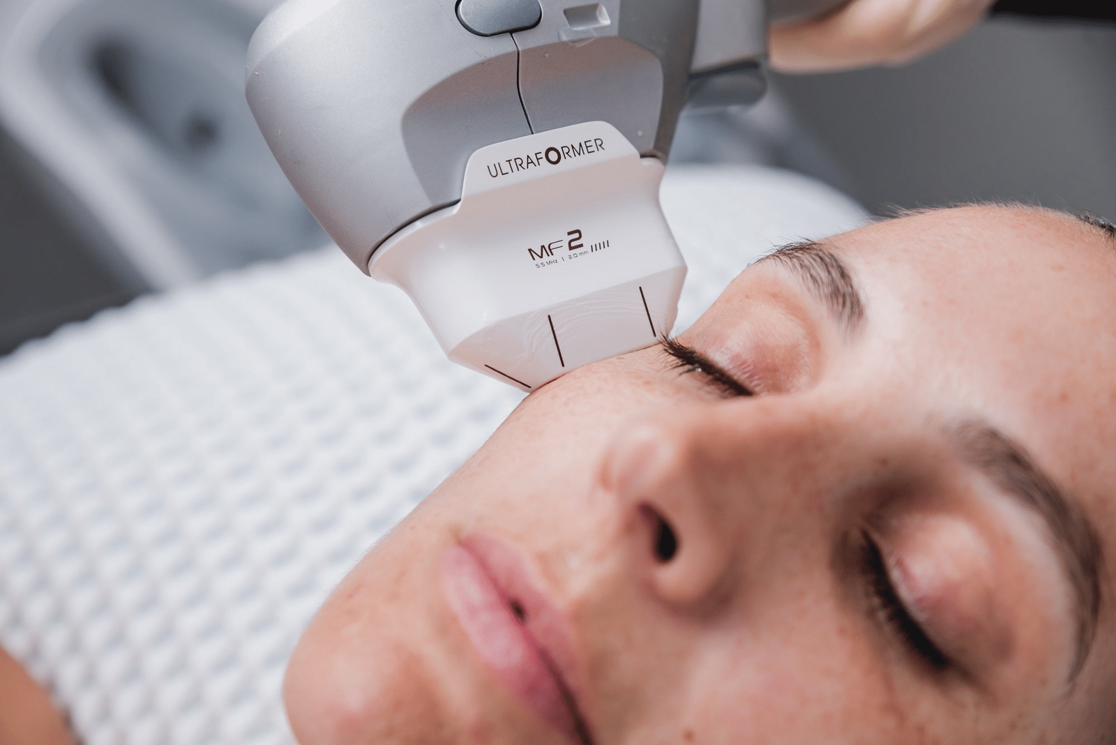 iSonic HIFU in Motion