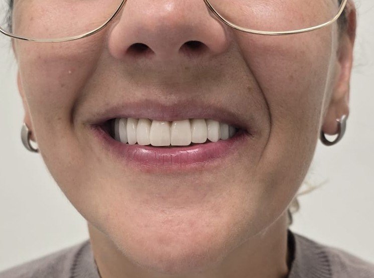 Vrouw met een ontspannen, natuurlijke glimlach